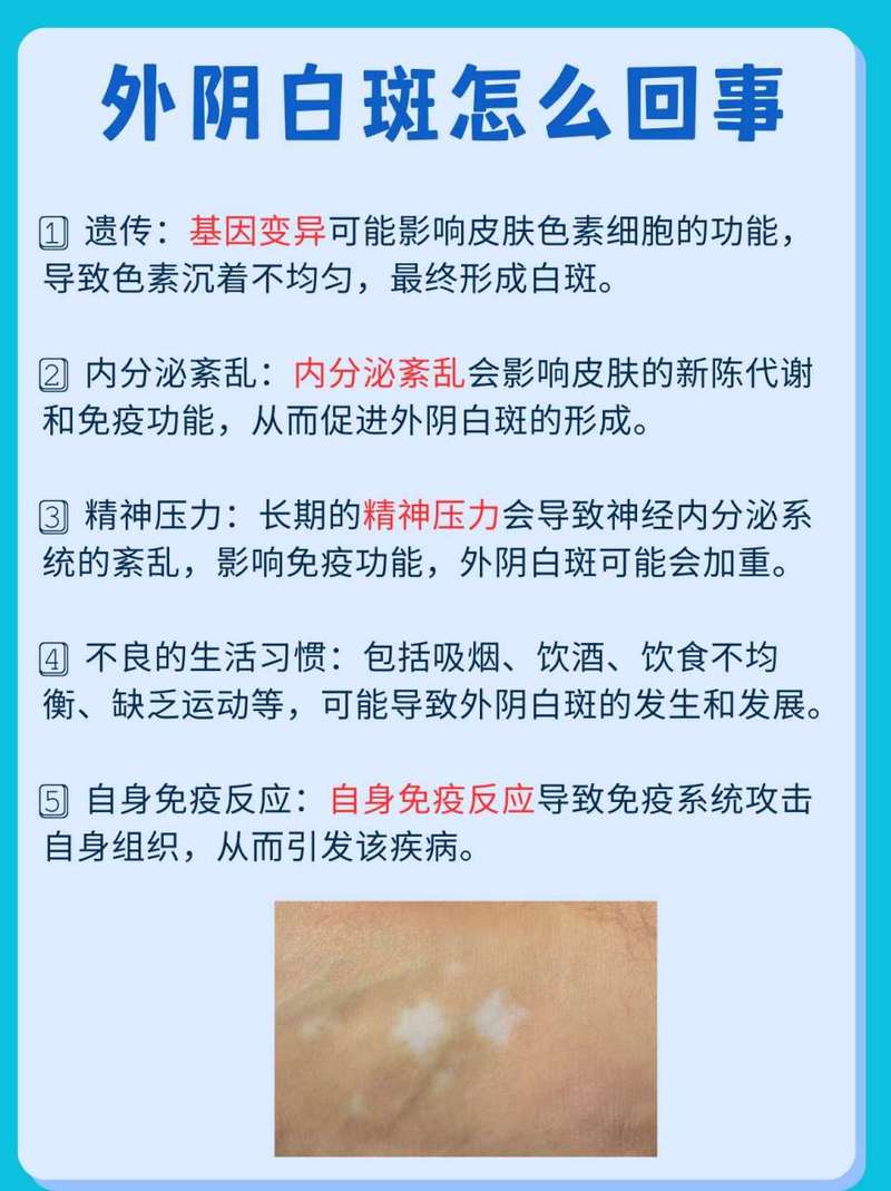 妇科白斑病是什么症状,妇科白斑病是什么症状图片