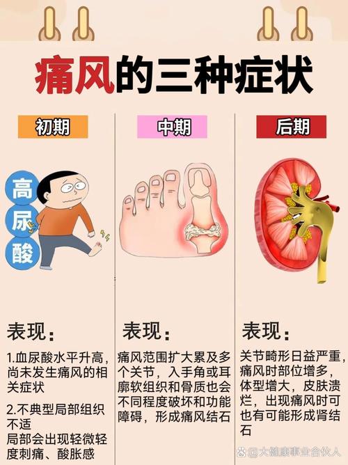 尿酸为什么会高,痛风尿酸为什么会高